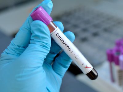 Atención Neuquén: el lunes abre con 103 nuevos casos de coronavirus