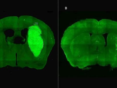Científicos del CONICET logran neutralizar un tumor agresivo