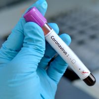 Coronavirus en Neuquén: con cuatro casos nuevos, crecen los contagios. ¡Atención!