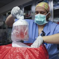 Fallece 1ra persona en recibir riñón de cerdo modificado genéticamente
