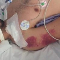 Policías golpean a un joven de 23 años en León… y lo dejan en coma