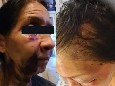 Pensó que era asiática y la golpeó brutalmente en EU; Yasmine ya fue arrestada