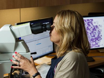 Inteligencia artificial podría diagnosticar cáncer de pulmón un año antes de métodos actuales