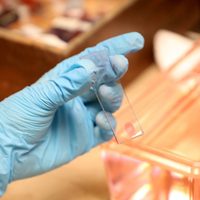 Trabajo nocturno y luz excesiva se relacionan con mayor riesgo de cáncer de mama o próstata: experta
