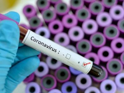 ¡Preocupación en Choele Choel! 4 empleados de un supermercado tienen coronavirus