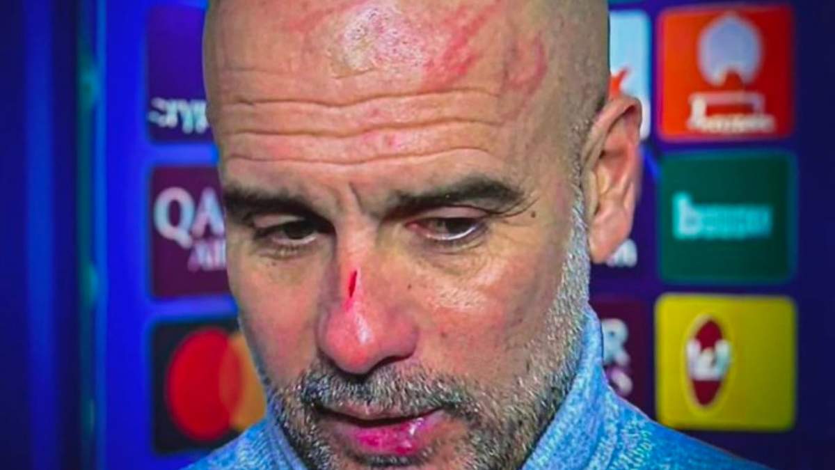 El técnico del Manchester City, Josep Guardiola