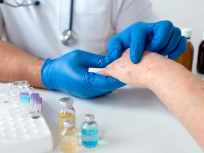 Alerta epidemiológica: cuántos casos de sarampión hay en Argentina