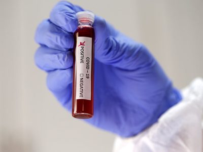 ¿Comienzan los test masivos de coronavirus?