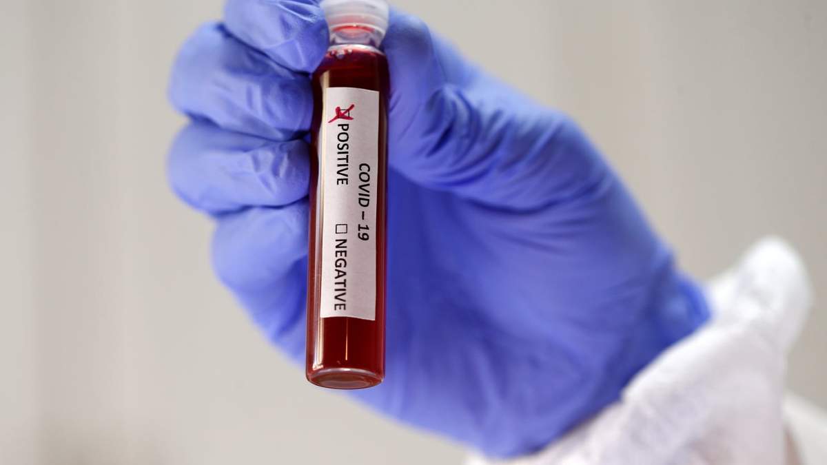 Coronavirus. Fuente: (Twitter)