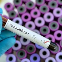 Zapala, con la cifra más baja de casos activos desde la llegada de la pandemia