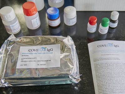 Coronavirus: el test serológico argentino superó una nueva marca de producción