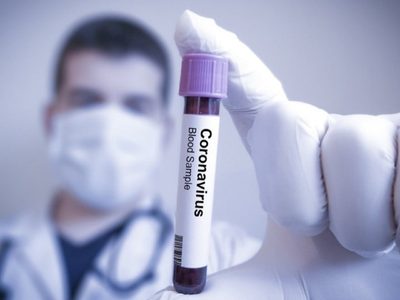El viernes cerró en Río Negro con 249 nuevos casos activos y 5 pacientes fallecidos