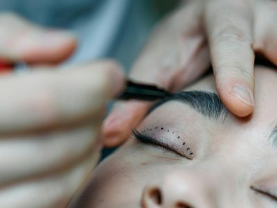 Creció el número de jóvenes que se someten a cirugías faciales