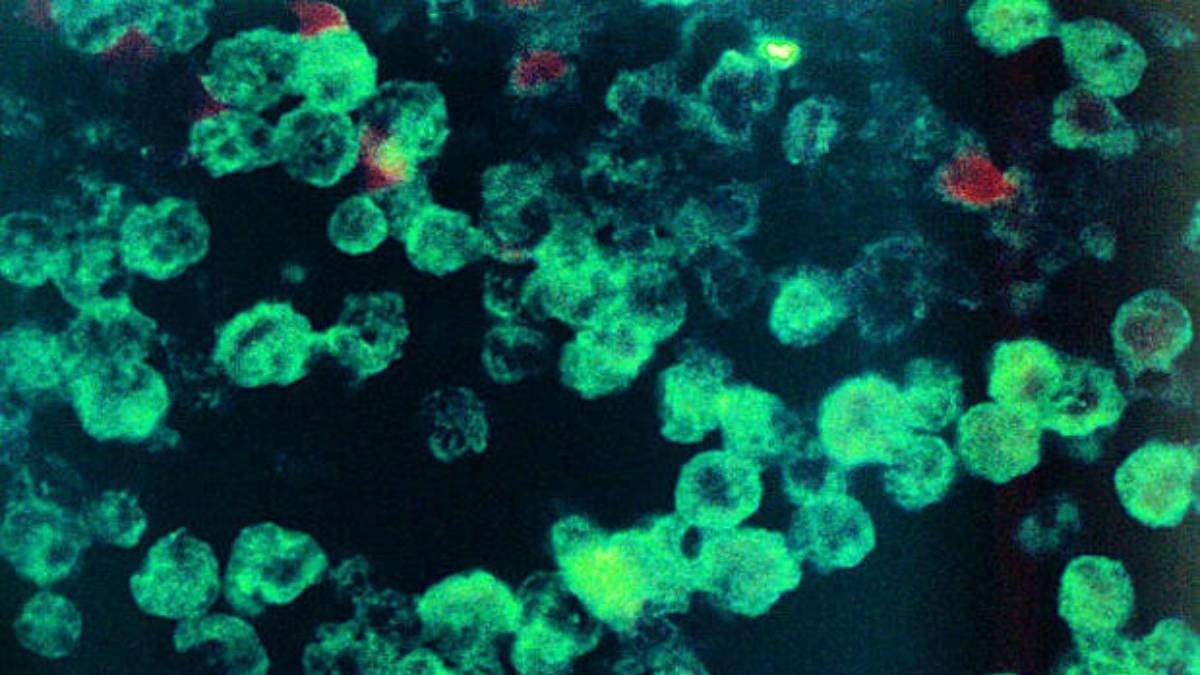 La ameba naegleria fowleri