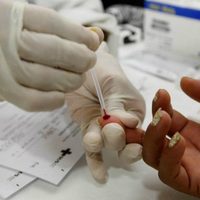 Se registró un crecimiento de los casos de sífilis: cómo está el panorama en Neuquén