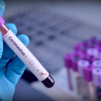 Neuquén: 19 nuevos casos de coronavirus y un importante anuncio
