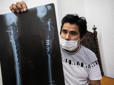 Las desdeñadas víctimas de la Línea 12: Ocho meses en “shock” postraumático