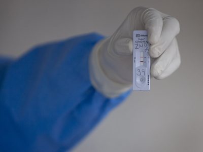 Anticuerpos contra SARS-CoV-2 son indetectables en casi el 50% de los infectados: Estudio