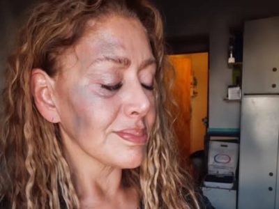 ATE repudió la agresión a una médica en Añelo y reclama seguridad en el hospital y las ambulancias