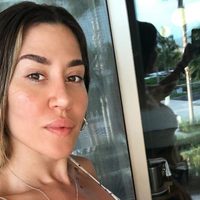 ¿¡Qué se hizo!? Jimena Barón mostró su cara totalmente cambiada y estallaron las redes