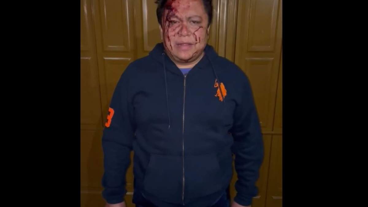 Gonzalo Juárez Méndez publicó un video tras la agresión