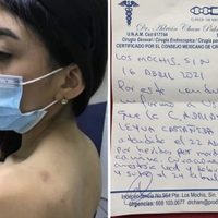 La novia del hombre que mató al perro "Rodolfo" intenta justificar la agresión y luego se deslinda