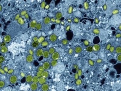 En 2030 más de mil millones de adolescentes tendrán mala alimentación, depresión y VIH: Lancet