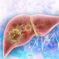 Las hepatitis virales causan más de un millón de muertes al año y afectan a 300 millones de personas