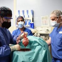 Murió David Bennet, el primer hombre trasplantado con un corazón de cerdo