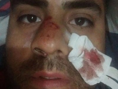 Borrachera, golpes, detenciones… el escándalo de basquetbolistas mexicanos en Argentina (Video)