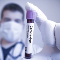 Coronavirus en Río Negro: se registraron 67 contagios y un fallecimiento