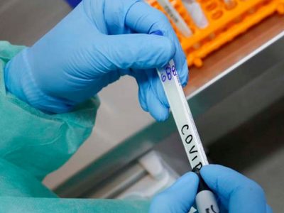 Se volvieron a disparar notoriamente los casos positivos de coronavirus en Zapala