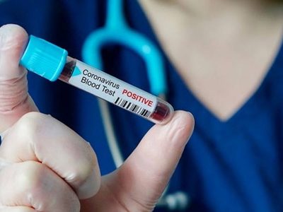 ¡Nuevo caso en Cinco Saltos! Son 97 los pacientes con coronavirus en Río Negro
