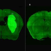Científicos del CONICET logran neutralizar un tumor agresivo