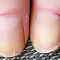 El consejo de las expertas en manicura para curar y sanar tus uñas si se abren por capas y están resecas