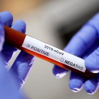 Coronavirus: Neuquén Capital confirmó 3 nuevos casos