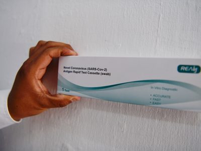 Coronavirus: 62 muertos y 10 mil 752 nuevos contagios reportados este martes