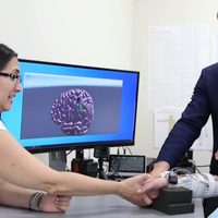 Con ayuda de Inteligencia Artificial, hombre cuadripléjico recupera movimiento en hospital de EU