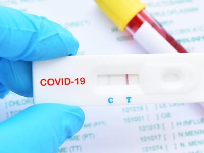 Coronavirus: Neuquén no permitirá la venta libre del test rápido