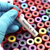 Por hepatitis, muere una persona cada 30 segundos en el mundo