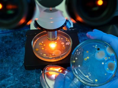 La bacteria "come carne" se encuentra en estos lugares: lo que debes saber para protegerte