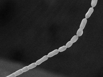 Hallaron la bacteria más grande jamás vista: es tal su tamaño, que desafía las leyes de la biología