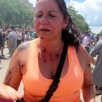 Human Rights Watch repudió la represión en Formosa