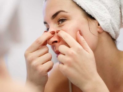 La mascarilla viral con solo 2 ingredientes, para sacar los puntos negros y dejar la piel de tu rostro impecable