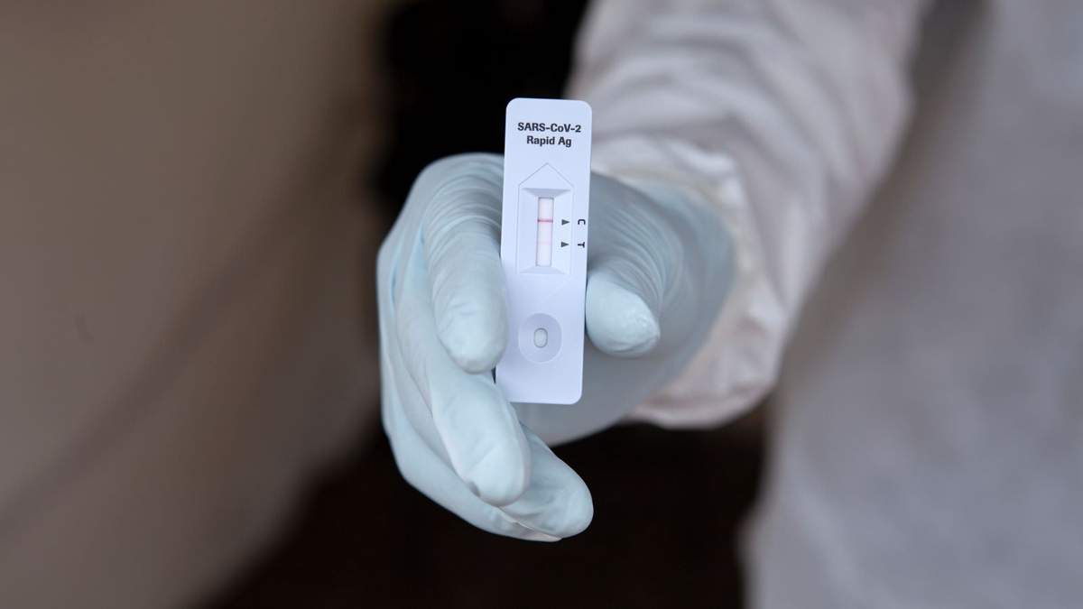 Prueba de influenza (imagen ilustrativa)