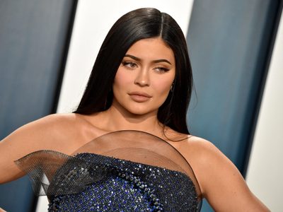 ¿DE VERDAD? Nadie puede creer que Kylie Jenner tenga sus pies en este estado. FOTOS