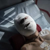 "En el infierno": soldados heridos son evacuados en Ucrania