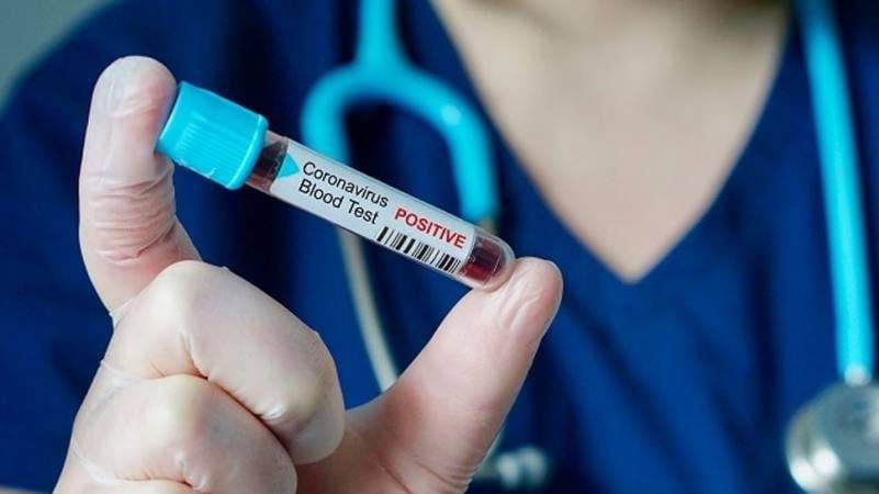 Neuquén suma tres nuevos casos confirmados de coronavirus. Fuente: (Twitter)
