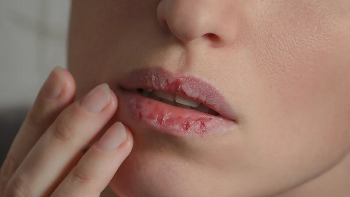 Labios. Fuente: (Instagram)