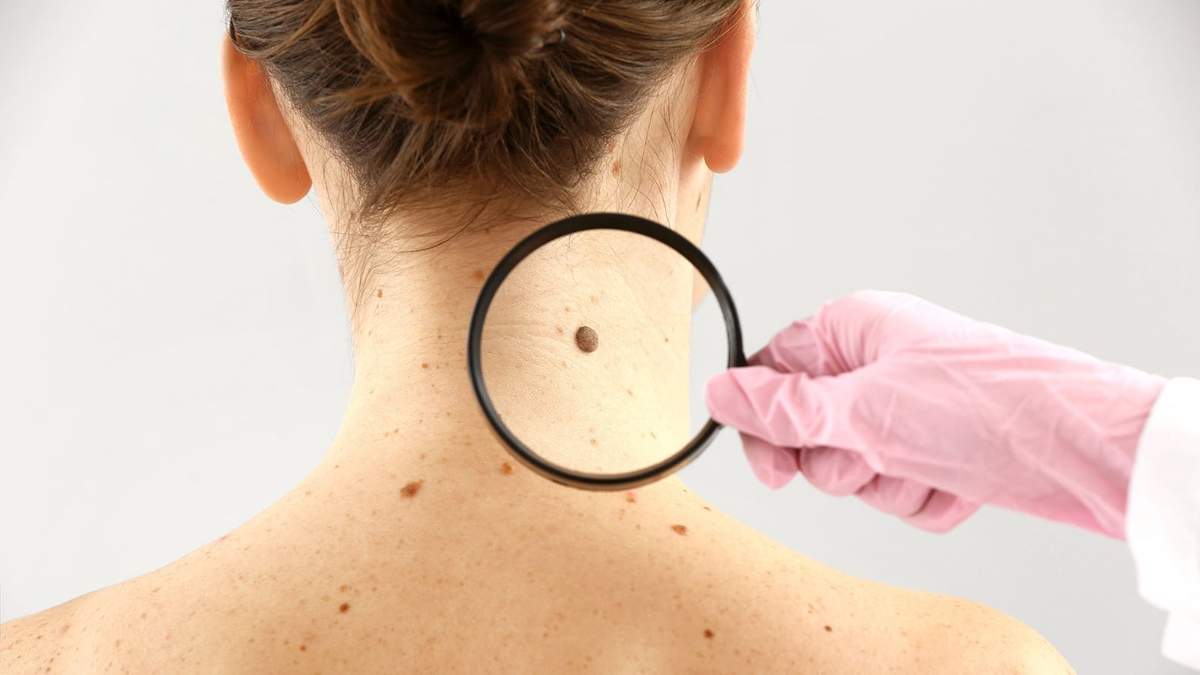 Controles dermatológico gratis en Neuquén Capital. Fuente: (Twitter)